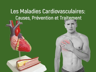 Les Maladies Cardiovasculaires : causes, prévention et traitement