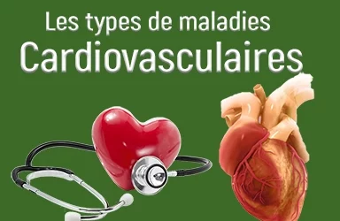 Exemples de Maladies Cardiovasculaires