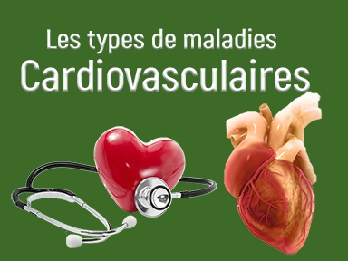 Exemples de maladies cardiovasculaires et prévention